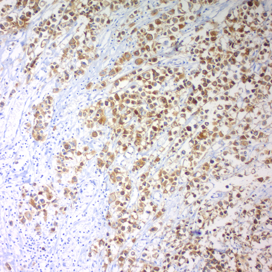 c-erbB-2 Oncoprotein; Clone SP3 (Ready-To-Use)